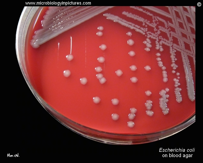 E.coli gamma-hemolysis